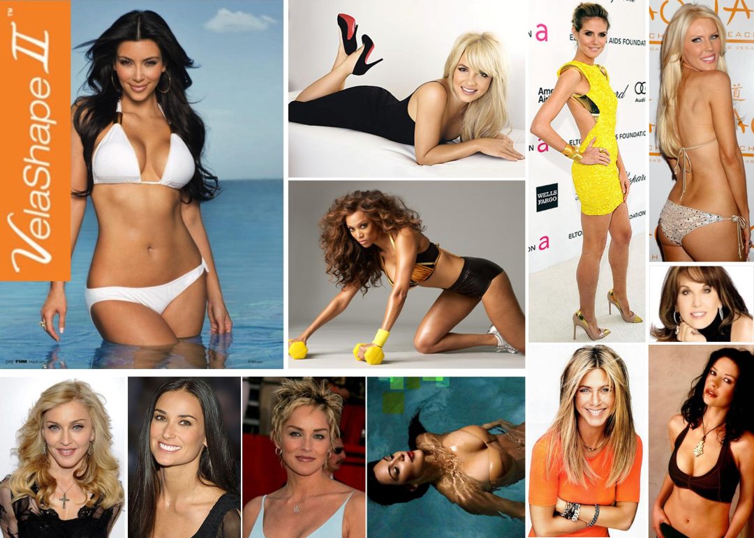 VelaShape™